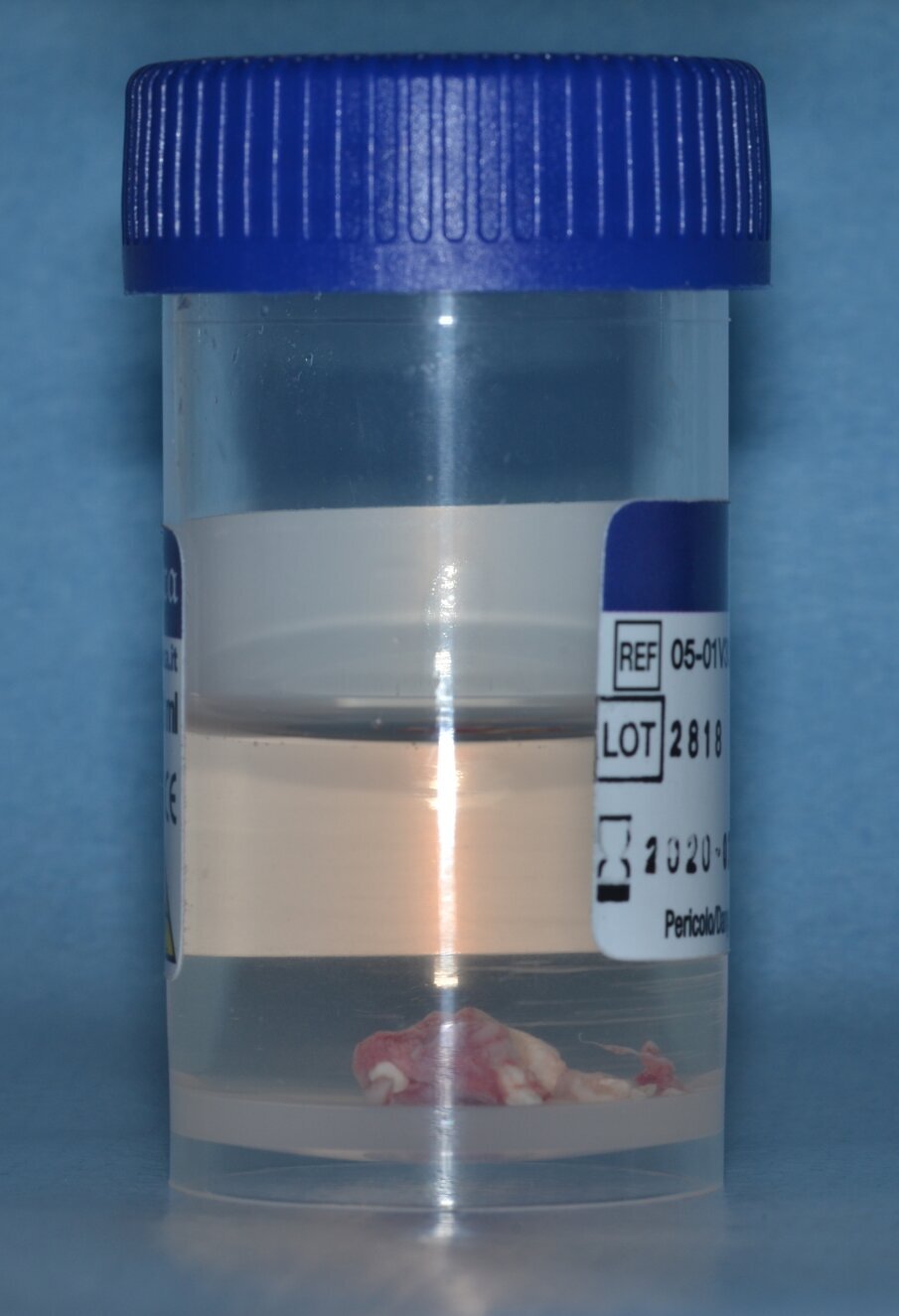 Fig. 12_Confezionamento e invio del pezzo operatorio per esame istologico.