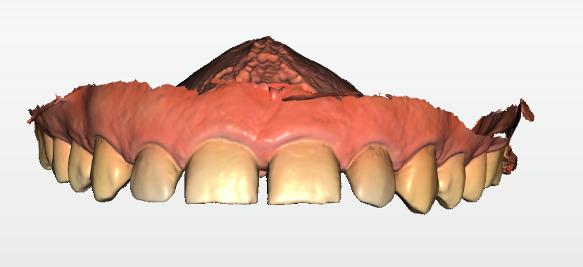 Fig. 2 - L’impronta ottica, visualizzazione frontale.