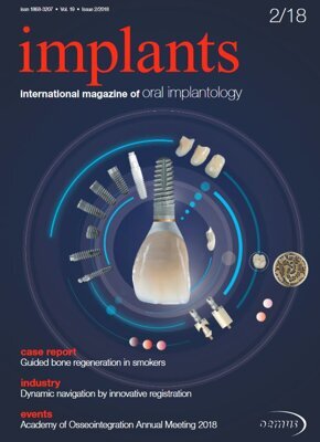 implants international No. 2, 2018 implants international No. 2, 2018