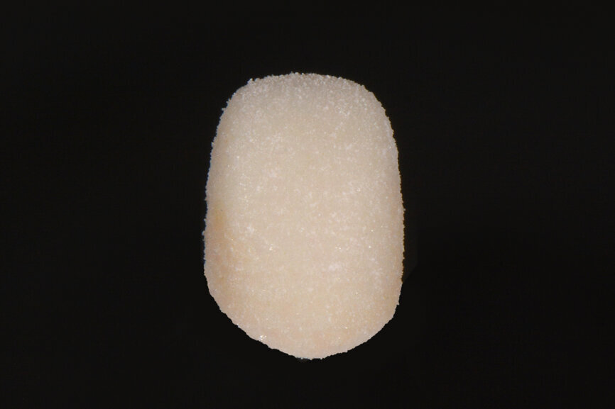 Fig. 2. Color dental base reproducido con AKZENT PLUS ES15 por cervical, ES06 en los dos tercios superiores y BASE.