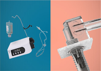 Nobel Biocare – GalvoSurge