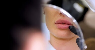 Filler all’acido ialuronico: le labbra voluminose possono esserlo 