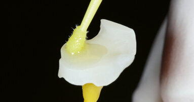 Easy and efficient: Composite resin blocks for the CAD/CAM technique