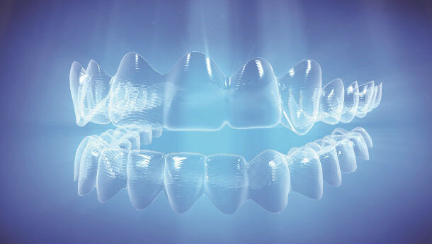Invisalign, nuove funzioni SmartForce per supportare gli specialisti nel trattamento dei casi più complessi