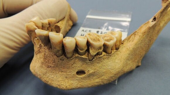 Проучване показва, че преминаването към съвременната диета засяга оралното здраве