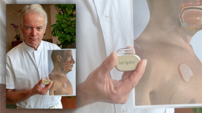 Obstruktive Schlafapnoe: Patient wird Zungenschrittmacher implantiert Obstruktive Schlafapnoe: Patient wird Zungenschrittmacher implantiert