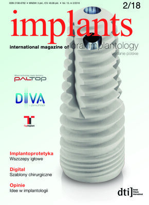 implants Poland No. 2, 2018 implants Poland No. 2, 2018