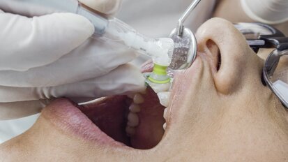 NEWSLETTER #02. La rentabilidad de la profilaxis