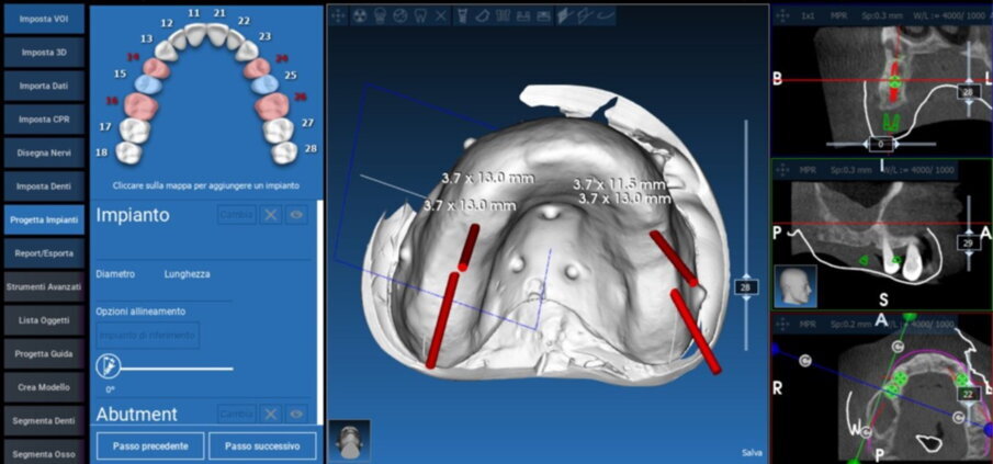 Figg. 19, 20_Progettazione Cad con software Realguide.