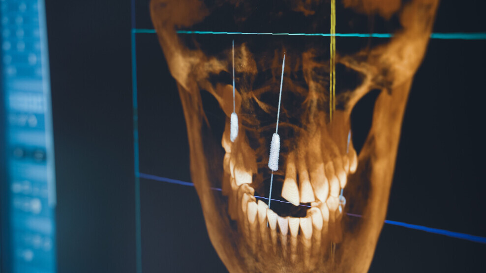 It is significant for dental professionals to understand the immunological impacts of dental procedures and the potential systemic effects of oral diseases. (Image: macondo/Shutterstock)