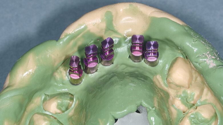 Opětovné implantologické ošetření