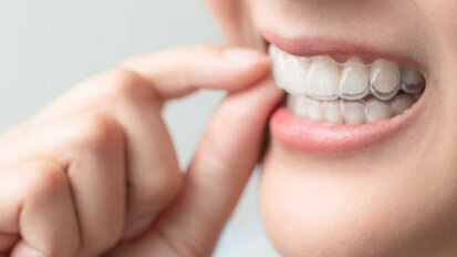 A prova di pandemia? Align Technology ha stabilito un nuovo record di vendita