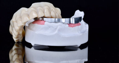 Utilizzo della stampante 3D in un flusso di lavoro totalmente digitale