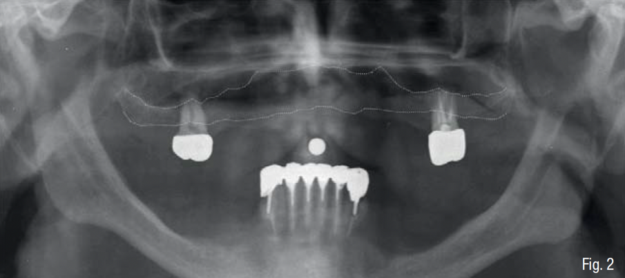 Fig. 2