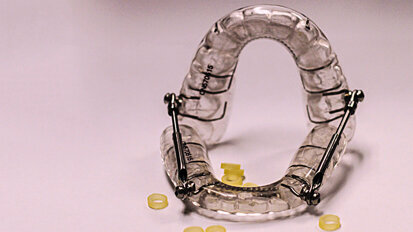 Aparatología de avance mandibular para Apnea del Sueño (2) Aparatología de avance mandibular para Apnea del Sueño (2)