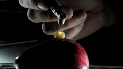 Tecnología láser hoy en Odontopediatría