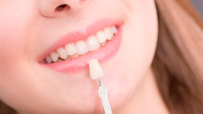 Il mercato dell’odontoiatria estetica raggiungerà i 22 miliardi di dollari entro il 2020