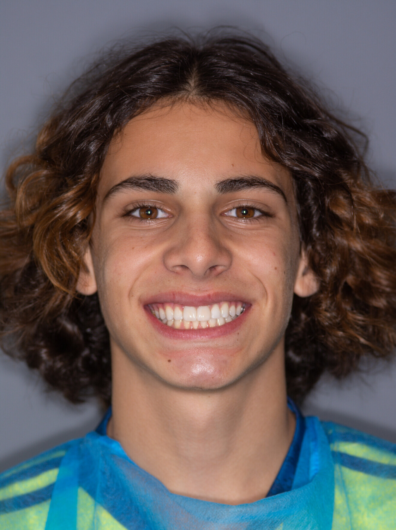 Sourire du patient après.