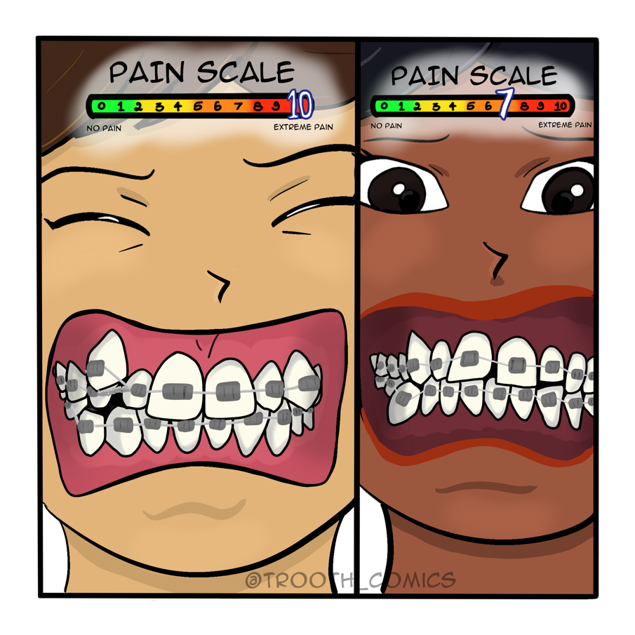 BDNF in Orthodontic pain 5