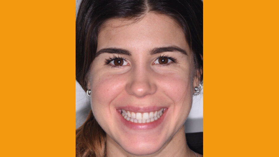 Fig. 1_Situazione iniziale.