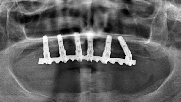 Studio pilota su 396 impianti