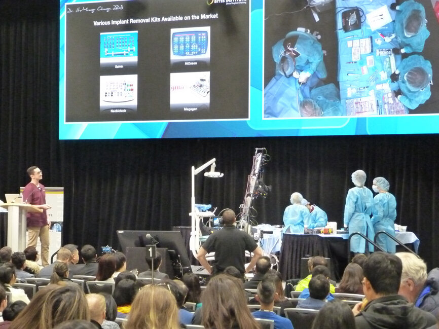 Dmitriy Ivanov, DDS, narrates as Ho-Young Chung, DDS, demonstrates ‘Surgical Options for Peri-Implantitis and Other Implant Complications’ on the Live Dentistry Stage Thursday morning in the PDC Exhibit Hall. (Photo: Robert Selleck/Dental Tribune)