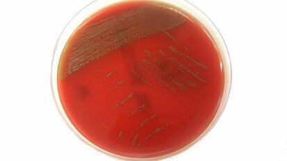 Une bactérie sur les muqueuses buccales pourrait provoquer des maladies graves si elle passe dans le sang