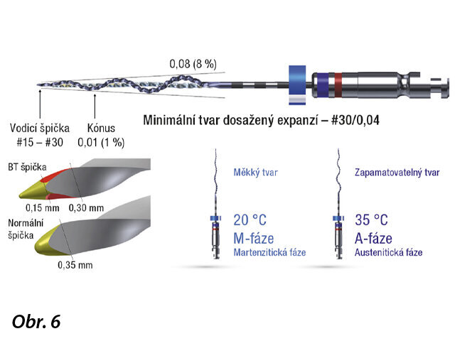 Zde je ukázán přehled jedinečných funkcí XP-endo Shaperu. Diskontinuální adaptivní pohyby pro debridement přesně napodobují Schilderovu plochu pohybu.