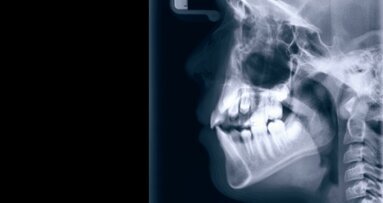 Die Bedeutung des Kiefergelenkes