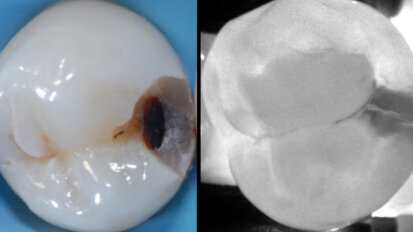 Primo Meeting Internazionale KaVo DIAGNOcam