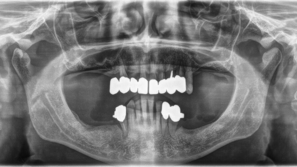 Contenzioso? No grazie! Come evitare in poche mosse rotte di collisione col paziente