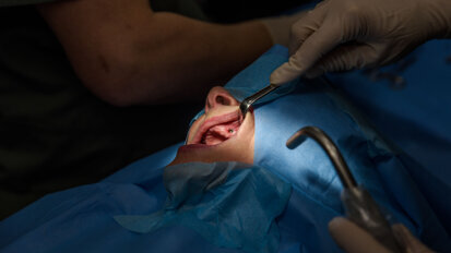 Implant treatment of the fully edentulous patient—contribution of digital techniques