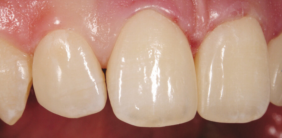 9. i 10. Lateralni prikaz neposredno nakon nadogradnje