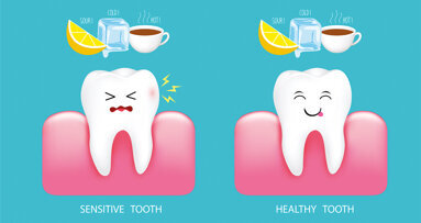 Shining the brightest light on sensitive teeth