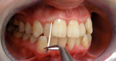 Applicazioni della diagnostica molecolare in odontostomatologia