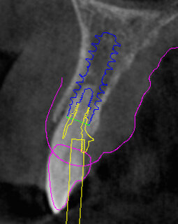Fig. 15 - Moncone SRA.