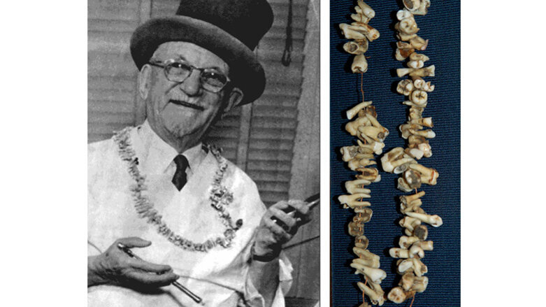 El gran “Painless Parker”, dentista y artista de circo