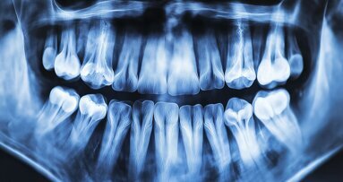 Minding the gap unconditionally: A case study