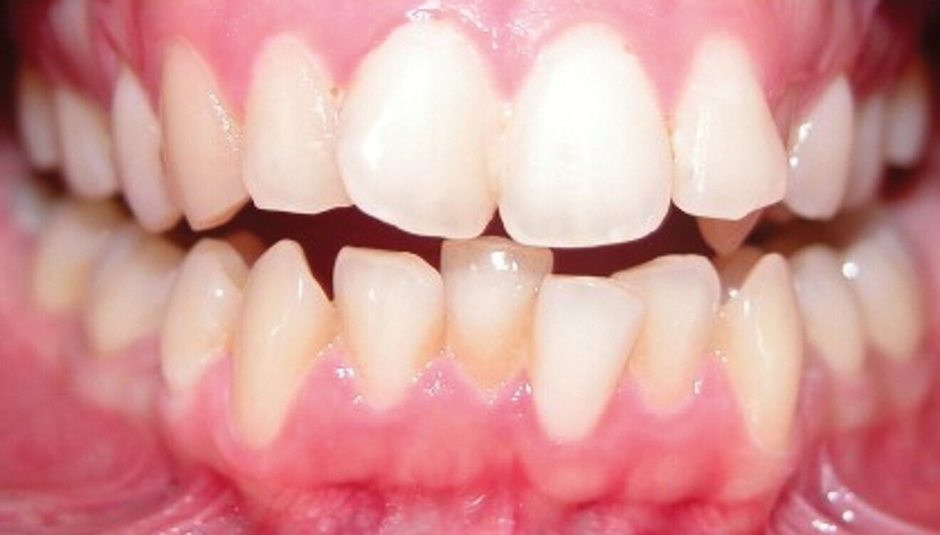 Fig. 1b : Photographie intraorale initiale.