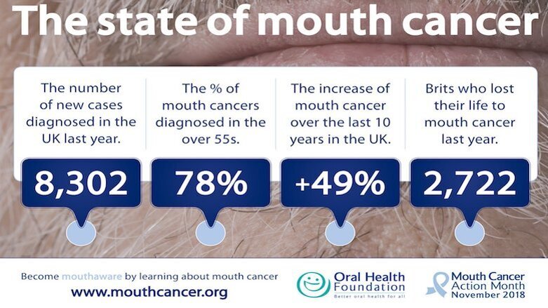Report shines a light on mouth cancer in the UK