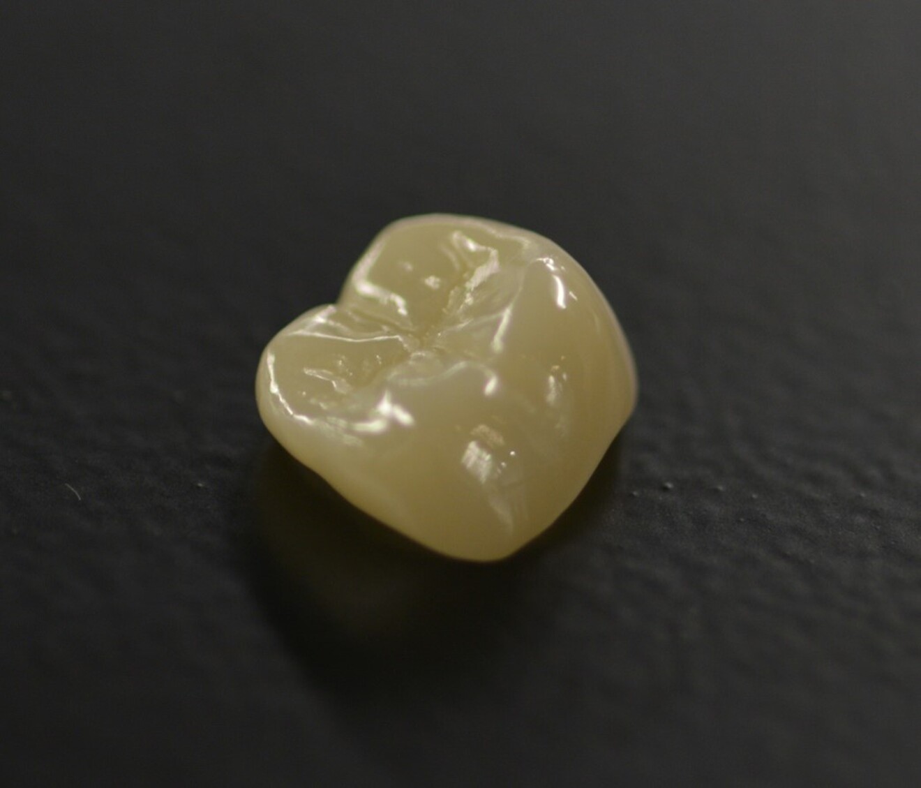 Fig. 13: Definitive zirconia crown fabricated based on the validated digital design.