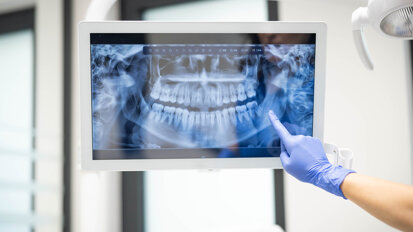 Jedes achte Röntgengerät mit Mängeln – das zeigt der TÜV-Report