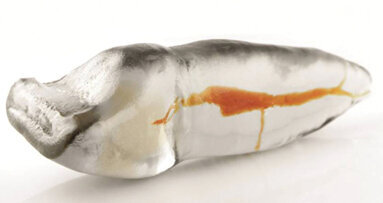 Redefining endodontic education