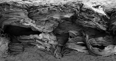 Knochenregeneration: Auf's Timing kommt es an!