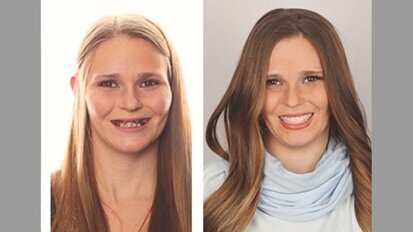 Caso Clínico: Una sonrisa para Andrea