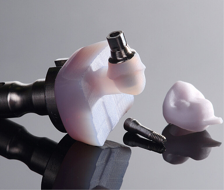 Fig. 37: The abutment was ground from an IPS e.max CAD Abutment MO block and the crown from IPS e.max CAD LT.