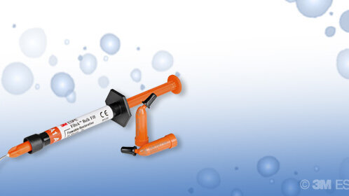 Αποκαταστάσεις ρητίνης τύπου bulk fill