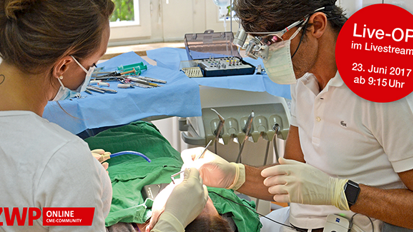 Morgen im Livestream: „Keramik ist einfacher – aber anders“ Morgen im Livestream: „Keramik ist einfacher – aber anders“