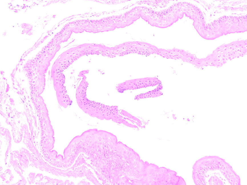 Ryc. 2: Preparat histopatologiczny, powiększenie x10, barwienie hematoksylina i eozyna.