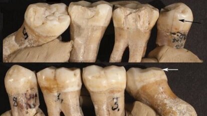 Evidence of prehistoric dentistry found in Neanderthal teeth